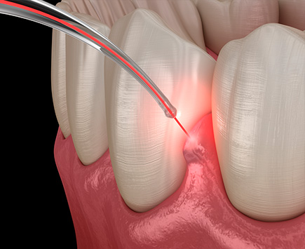 Пародонтология - диагностика, лечение и профилактика