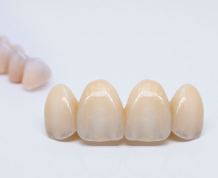 Протетична стоматология - подвижно и неподвижно протезиране